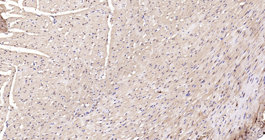 Anti-AMPK alpha 1 (phospho Thr183) + AMPK alpha 2 (phospho Thr172) antibody used in IHC (Paraffin sections) (IHC-P). GTX03702