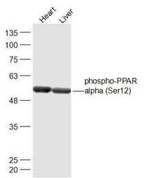 Anti-PPAR alpha (phospho Ser12) antibody used in Western Blot (WB). GTX03713