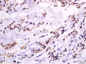 Anti-GSDMA antibody used in IHC (Paraffin sections) (IHC-P). GTX03715