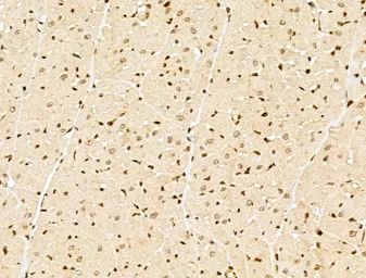 Anti-NCOA6 antibody used in IHC (Paraffin sections) (IHC-P). GTX03716