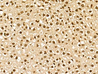 Anti-NCOA6 antibody used in IHC (Paraffin sections) (IHC-P). GTX03716