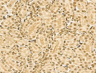 Anti-NCOA6 antibody used in IHC (Paraffin sections) (IHC-P). GTX03716