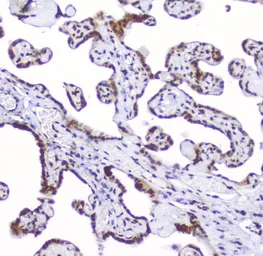 Anti-AHR antibody used in IHC (Paraffin sections) (IHC-P). GTX03719