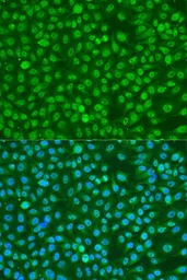 Anti-BRCA1 (phospho Ser1423) antibody used in Immunocytochemistry/ Immunofluorescence (ICC/IF). GTX03784