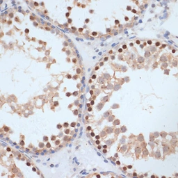 Anti-BRCA1 (phospho Ser1423) antibody used in IHC (Paraffin sections) (IHC-P). GTX03784