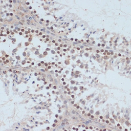 Anti-BRCA1 (phospho Ser1423) antibody used in IHC (Paraffin sections) (IHC-P). GTX03784