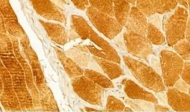 Anti-CXCL1 / GRO alpha antibody used in IHC (Paraffin sections) (IHC-P). GTX03810