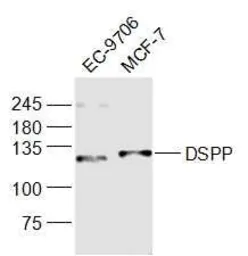 Anti-DSPP antibody used in Western Blot (WB). GTX04076