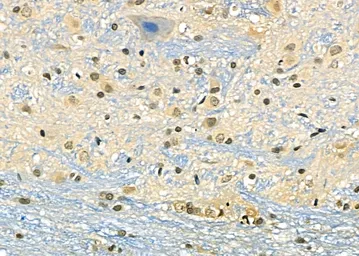 Anti-DMP1 antibody used in IHC (Paraffin sections) (IHC-P). GTX04077