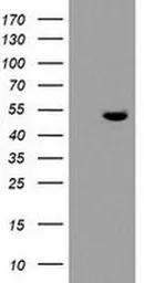 Anti-TDO2 antibody [OTI2A4] used in Western Blot (WB). GTX04090