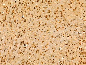 Anti-ARC antibody used in IHC (Paraffin sections) (IHC-P). GTX04096