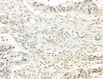 Anti-CCR2 antibody used in IHC (Paraffin sections) (IHC-P). GTX04115