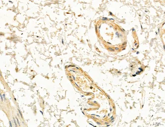 Anti-CCR2 antibody used in IHC (Paraffin sections) (IHC-P). GTX04115