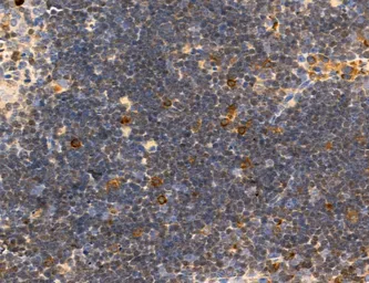 Anti-CCR2 antibody used in IHC (Paraffin sections) (IHC-P). GTX04115