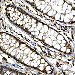 Anti-GLI3 antibody used in IHC (Paraffin sections) (IHC-P). GTX04242