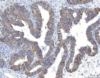 Anti-CD155 antibody [5I13D1] used in IHC (Paraffin sections) (IHC-P). GTX04249