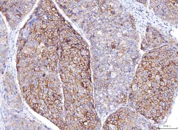 Anti-CD155 antibody [5I13D1] used in IHC (Paraffin sections) (IHC-P). GTX04249