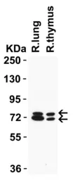 Anti-NCOA4 antibody used in Western Blot (WB). GTX04250
