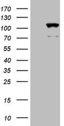 Anti-CIP2A antibody [OTI9E6] used in Western Blot (WB). GTX04253