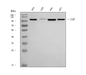 Anti-FAP antibody used in Western Blot (WB). GTX04307