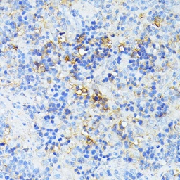 Anti-TP53I11 antibody used in IHC (Paraffin sections) (IHC-P). GTX04308