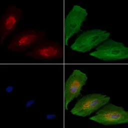 Anti-WNK3 antibody used in Western Blot (WB). GTX04322