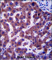 Anti-SC4MOL antibody used in IHC (Paraffin sections) (IHC-P). GTX04338