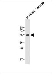 Anti-PAX7 antibody used in Western Blot (WB). GTX04357
