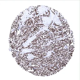Anti-pan Cytokeratin antibody [MSVA-000R] HistoMAX&trade; used in IHC (Paraffin sections) (IHC-P). GTX04363