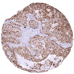 Anti-Napsin A antibody [MSVA-112R] HistoMAX&trade; used in IHC (Paraffin sections) (IHC-P). GTX04366