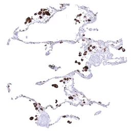 Anti-Napsin A antibody [MSVA-112R] HistoMAX&trade; used in IHC (Paraffin sections) (IHC-P). GTX04366