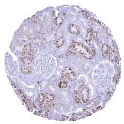 Anti-Napsin A antibody [MSVA-112R] HistoMAX&trade; used in IHC (Paraffin sections) (IHC-P). GTX04366
