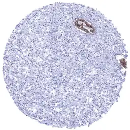 Anti-E-Cadherin antibody [MSVA-035R] HistoMAX&trade; used in IHC (Paraffin sections) (IHC-P). GTX04367