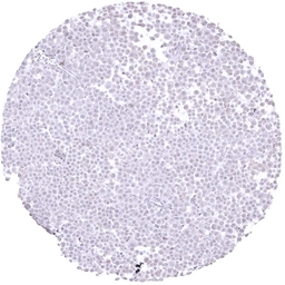Anti-E-Cadherin antibody [MSVA-035R] HistoMAX&trade; used in IHC (Paraffin sections) (IHC-P). GTX04367