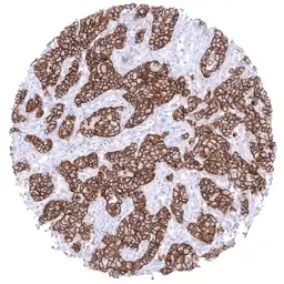 Anti-E-Cadherin antibody [MSVA-035R] HistoMAX&trade; used in IHC (Paraffin sections) (IHC-P). GTX04367