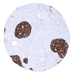 Anti-Synaptophysin antibody [MSVA-462R] HistoMAX&trade; used in IHC (Paraffin sections) (IHC-P). GTX04371