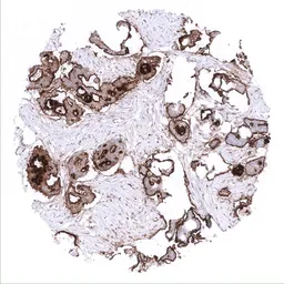 Anti-Mesothelin antibody [MSVA-235M] HistoMAX&trade; used in IHC (Paraffin sections) (IHC-P). GTX04373