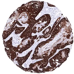 Anti-Cytokeratin 14 antibody [MSVA-614R] HistoMAX&trade; used in IHC (Paraffin sections) (IHC-P). GTX04377