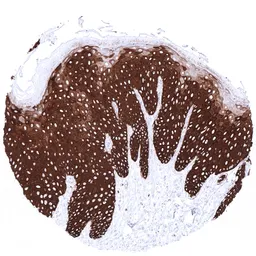 Anti-Cytokeratin 14 antibody [MSVA-614R] HistoMAX&trade; used in IHC (Paraffin sections) (IHC-P). GTX04377