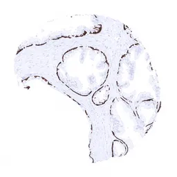 Anti-Cytokeratin 14 antibody [MSVA-614R] HistoMAX&trade; used in IHC (Paraffin sections) (IHC-P). GTX04377