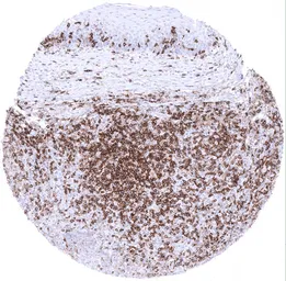 Anti-CD4 antibody [MSVA-004R] HistoMAX&trade; used in IHC (Paraffin sections) (IHC-P). GTX04379
