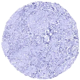 Anti-EpCAM antibody [MSVA-326R] HistoMAX&trade; used in IHC (Paraffin sections) (IHC-P). GTX04380