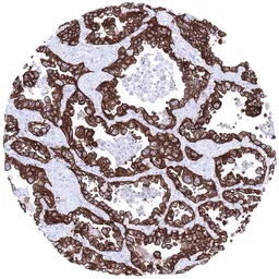Anti-EpCAM antibody [MSVA-326R] HistoMAX&trade; used in IHC (Paraffin sections) (IHC-P). GTX04380