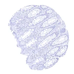 Anti-Melanoma gp100 antibody [MSVA-617R] HistoMAX&trade; used in IHC (Paraffin sections) (IHC-P). GTX04382