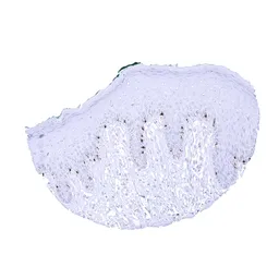 Anti-Melanoma gp100 antibody [MSVA-617R] HistoMAX&trade; used in IHC (Paraffin sections) (IHC-P). GTX04382