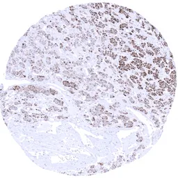 Anti-Melan A antibody [MSVA-901M+] HistoMAX&trade; used in IHC (Paraffin sections) (IHC-P). GTX04384