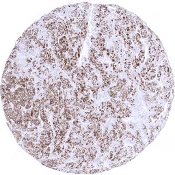 Anti-Melan A antibody [MSVA-901M+] HistoMAX&trade; used in IHC (Paraffin sections) (IHC-P). GTX04384