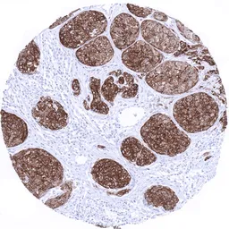 Anti-Melan A antibody [MSVA-901M+] HistoMAX&trade; used in IHC (Paraffin sections) (IHC-P). GTX04384