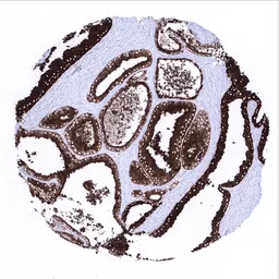 Anti-Prostatic Acid Phosphatase antibody [MSVA-452M] HistoMAX&trade; used in IHC (Paraffin sections) (IHC-P). GTX04396