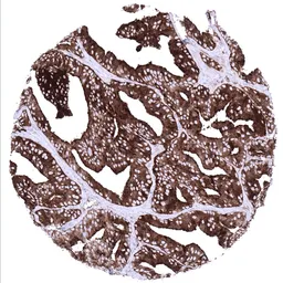 Anti-Prostatic Acid Phosphatase antibody [MSVA-452M] HistoMAX&trade; used in IHC (Paraffin sections) (IHC-P). GTX04396